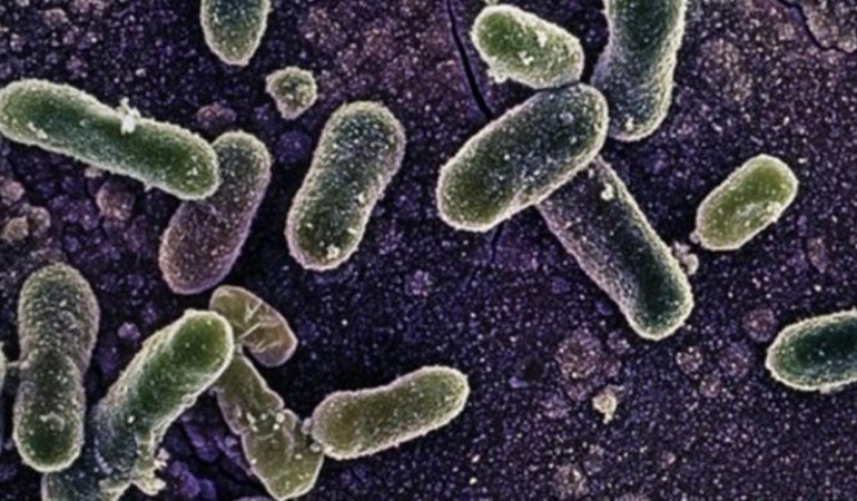 Belçikadaki Salmonella salgınında vaka sayısı 318e yükseldi.