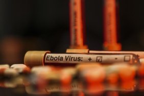 Kongo-Demokratik-Cumhuriyetinde-Ebola-salgininda-vaka-sayisi-7-bini-asti-featured