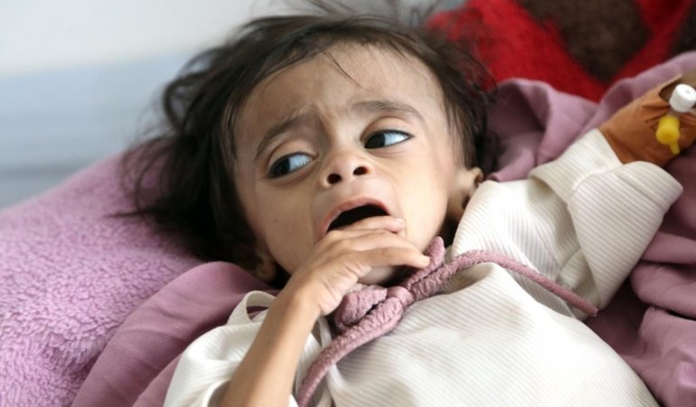 BMden Yemende insani kriz uyarısı